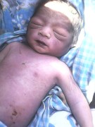 Ants Bite Infant To Death In Hospital.