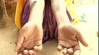 Rajasthan: Husband And His Family Allegedly Tattooed 'Abuse' On Wife 