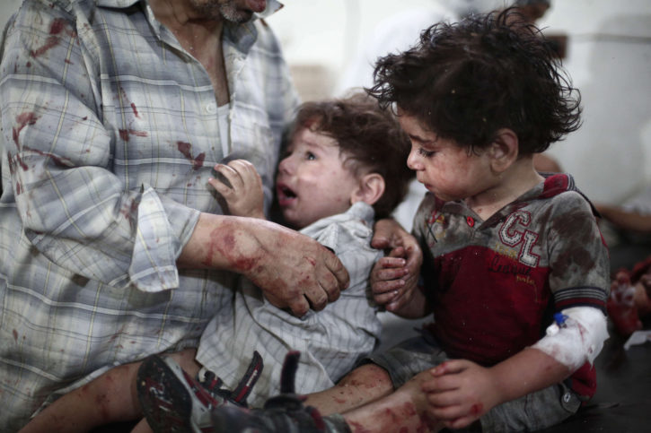children injured in syria