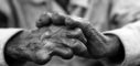 Love the Lepers, Don’t Loathe Them – Eliminating Leprosy is Necessary Love the Lepers,Leprosy is Necessary,Lepers Not Loathe,science news, lepers act,leprosy in india 2016,leprosy eradication in india,leprosy eradication