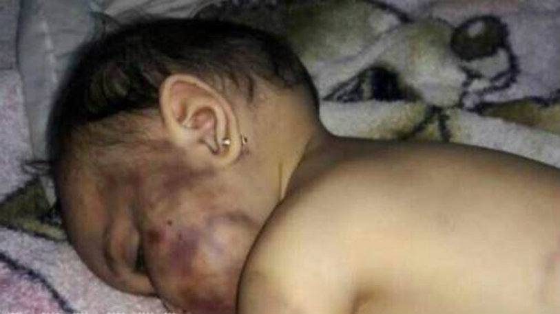 Father Bites Daughter To Death In Syria,Mango News,shocking incident,Jaramana area,Damascus,Dalal,Syrian community,Father bites daughter to death,Syrian father bites his baby daughter to death