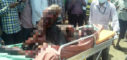 Hyderabad,Hyderabad news,Hyderabad Cylinder Blast,Cylinder Blast case,Ramakrishna,Osmania hospital,DCP Venkateshwar Rao