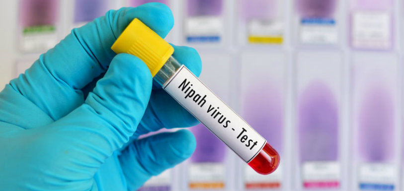 Nipah Virus,Center Forms Team To Investigate Disease In Kerala,Mango News,Current Breaking News,India News Live Updates,Kerala Breaking News,Nipah Virus Scare,Nipah Virus in Kerala,Nipah Virus Latest News,Director of National Center for Disease Control
