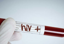 London Man The Second To be Cured Of HIV, HIV Cure latest news, Mango News, London HIV Patient Cleared Of AIDS Virus, AIDS Virus Cure, Bone Marrow Transplanation, HIV Positive London Man, keys to AIDS treatment, Gene Mutation to Cure HIV, Aids Treatment latest method