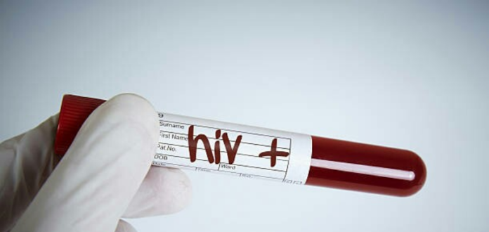 London Man The Second To be Cured Of HIV, HIV Cure latest news, Mango News, London HIV Patient Cleared Of AIDS Virus, AIDS Virus Cure, Bone Marrow Transplanation, HIV Positive London Man, keys to AIDS treatment, Gene Mutation to Cure HIV, Aids Treatment latest method