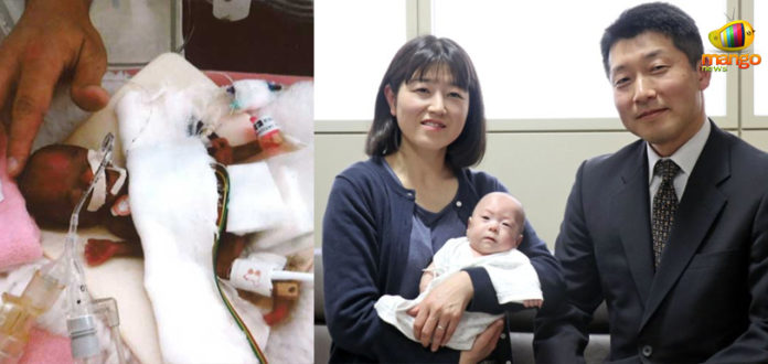 Japan This Is The World’s Smallest Baby Boy,Mango News,Breaking News Today,Japan Latest News,World Smallest Baby Boy,Smallest Baby Boy,smallest and lightest baby Boy,world’s lightest baby Boy,Ryusuke’s parents