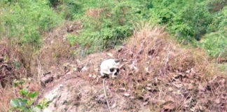 Bihar – SKMC Hospital Authorities Dumping Dead Bodies In Open?, SKMC investigation Team, human skeletons near Sri Krishna Medical College, Bihar Muzaffarpur Hospital, dumping skeletons near Bihar Hospital, Mango News, Skeletals found behind Muzaffarpur hospital, Hundreds of human skeletons near Bihar hospital,