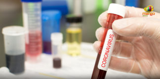 80 Cases Reported In Last 24 Hours In AP, andhra pradesh, AP Corona Positive Cases, AP Coronavirus, AP COVID 19 Cases, AP Total Positive Cases, Corona Positive Cases, Coronavirus, Coronavirus Breaking News, Coronavirus live updates, Coronavirus Update in AP, COVID-19, Total Corona Cases In AP