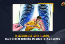 TB Cases Crosses 2 Lakh In Telangana, Health Department On Track And Aims TB Free State By 2025 TB Cases Crosses 2 Lakh In Telangana Health Department On Track And Aims TB Free State By 2025, TB Cases Crosses 2 Lakh In Telangana, Telangana Health Department On Track And Aims TB Free State By 2025, TB Free Telangana State By 2025, 2 Lakh TB Cases In Telangana, Telangana Health Department, TB Cases, Tuberculosis Cases increased, Tuberculosis Cases increased In Telangana State, Tuberculosis Cases In Telangana, Tuberculosis Cases In Telangana Latest News, Tuberculosis Cases In Telangana Latest Updates, Tuberculosis Cases In Telangana Live Updates, Mango News,