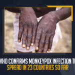 WHO Confirms Monkeypox Infection To Spread In 23 Countries So Far, WHO Warns Monkeypox Spreads in 23 Countries and Poses Moderate Risk To Public Health, Monkeypox Spreads in 23 Countries and Poses Moderate Risk To Public Health, WHO Warns Monkeypox Spreads in 23 Countries, Poses Moderate Risk To Public Health, Monkeypox confirmed in 23 nations, Poses moderate Risk, Monkeypox spreads to 23 countries, total 257 Monkeypox confirmed cases, World Health Organization, Public Health, World Health Organization Warns Monkeypox Spreads in 23 Countries, World Health Organization Warns 23 Countries, 23 Countries, Monkeypox News, Monkeypox Latest News, Monkeypox Latest Updates, Monkeypox Live Updates, Mango News,