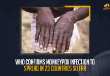 WHO Confirms Monkeypox Infection To Spread In 23 Countries So Far, WHO Warns Monkeypox Spreads in 23 Countries and Poses Moderate Risk To Public Health, Monkeypox Spreads in 23 Countries and Poses Moderate Risk To Public Health, WHO Warns Monkeypox Spreads in 23 Countries, Poses Moderate Risk To Public Health, Monkeypox confirmed in 23 nations, Poses moderate Risk, Monkeypox spreads to 23 countries, total 257 Monkeypox confirmed cases, World Health Organization, Public Health, World Health Organization Warns Monkeypox Spreads in 23 Countries, World Health Organization Warns 23 Countries, 23 Countries, Monkeypox News, Monkeypox Latest News, Monkeypox Latest Updates, Monkeypox Live Updates, Mango News,