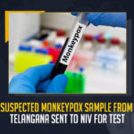 Suspected Monkeypox Sample From Telangana Sent To NIV For Test, Telangana Fever Hospital Superintendent Responds Over Health Condition of Suspected Kamareddy Monkeypox Patient, Fever Hospital Superintendent Responds Over Health Condition of Suspected Kamareddy Monkeypox Patient, Health Condition of Suspected Kamareddy Monkeypox Patient, Kamareddy Monkeypox Patient, Telangana Monkeypox Patient, Telangana Fever Hospital Superintendent, Fever Hospital Superintendent, Telangana first suspected Monkeypox case, Telangana Monkeypox case, TS Reports Suspected Monkeypox case, Telangana Monkeypox case News, Telangana Monkeypox case Latest News, Telangana Monkeypox case Latest Updates, Telangana Monkeypox case Live Updates, Mango News,