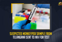 Suspected Monkeypox Sample From Telangana Sent To NIV For Test, Telangana Fever Hospital Superintendent Responds Over Health Condition of Suspected Kamareddy Monkeypox Patient, Fever Hospital Superintendent Responds Over Health Condition of Suspected Kamareddy Monkeypox Patient, Health Condition of Suspected Kamareddy Monkeypox Patient, Kamareddy Monkeypox Patient, Telangana Monkeypox Patient, Telangana Fever Hospital Superintendent, Fever Hospital Superintendent, Telangana first suspected Monkeypox case, Telangana Monkeypox case, TS Reports Suspected Monkeypox case, Telangana Monkeypox case News, Telangana Monkeypox case Latest News, Telangana Monkeypox case Latest Updates, Telangana Monkeypox case Live Updates, Mango News,