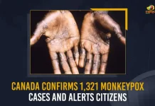 Canada Confirms 1321 Monkeypox Cases And Alerts Citizens, Canada Confirms 1321 Monkeypox Cases, Canada Confirms Monkeypox Cases, Monkeypox Cases In Canada, Mango News, Mango News Telugu, Monkeypox, Monkeypox Live Updates, Monkeypox Signs, Monkeypox Symptoms, Monkeypox Outbreak 2022, Monkeypox Virus, Monkeypox Virus Infection, Monkeypox Latest News And Updates, Monkeypox Virus News And Live Updates