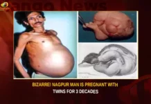 Bizarre Nagpur Man Is Pregnant With Twins For 3 Decades,Bizarre Nagpur Man Is Pregnant,Bizarre Nagpur Man With Twins,Bizarre Nagpur Man For 3 Decades,Nagpur Man Is Pregnant For 3 Decades,Mango News,Rare medical condition,Nagpur Man Carried Twin,In rare Fetus in fetu case,Man from Nagpur was Pregnant,Man With Twin Living Inside Him,The Shocking Tale of a Man,Nagpur Man Pregnant Latest News,Nagpur Man Pregnant Latest Updates,Nagpur Man Pregnant Live News,Nagpur Latest News,Nagpur Latest Updates,Nagpur Live News