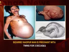 Bizarre Nagpur Man Is Pregnant With Twins For 3 Decades,Bizarre Nagpur Man Is Pregnant,Bizarre Nagpur Man With Twins,Bizarre Nagpur Man For 3 Decades,Nagpur Man Is Pregnant For 3 Decades,Mango News,Rare medical condition,Nagpur Man Carried Twin,In rare Fetus in fetu case,Man from Nagpur was Pregnant,Man With Twin Living Inside Him,The Shocking Tale of a Man,Nagpur Man Pregnant Latest News,Nagpur Man Pregnant Latest Updates,Nagpur Man Pregnant Live News,Nagpur Latest News,Nagpur Latest Updates,Nagpur Live News